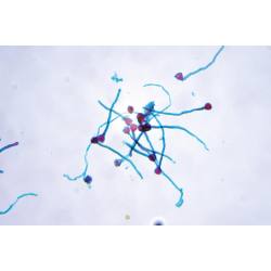 ※観察例です。