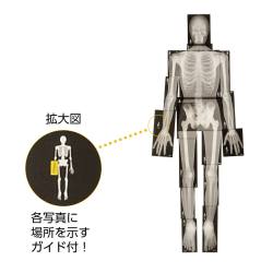 人体レントゲン写真セット XRAY－100【りかなび】ケニス株式会社